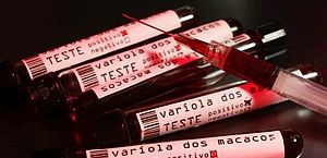 Sobe para 24 número de casos suspeitos de varíola dos macacos em Alagoas