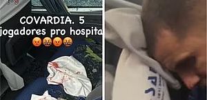 Motorista de ônibus do Fortaleza detalha ataque após jogo em Pernambuco