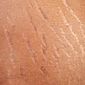 Cuidados com a pele: confira quatro dicas para eliminar estrias